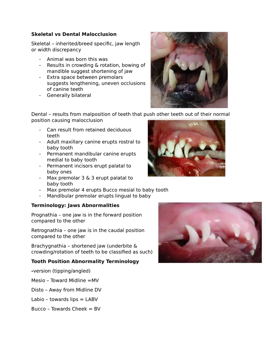 Malocclusion - Page 2