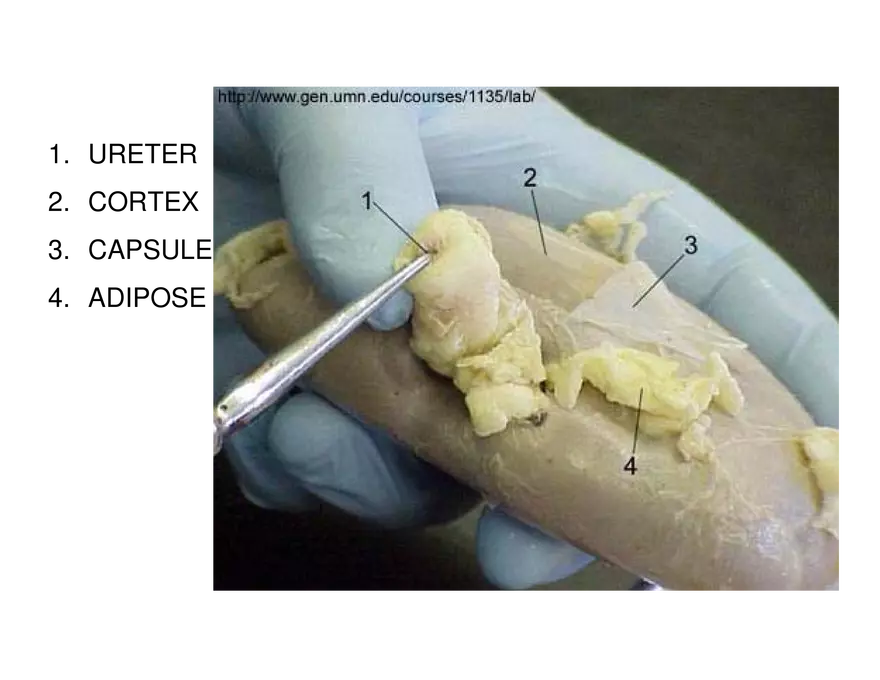 Urinary System Lecture - Page 101