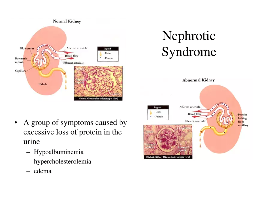 Urinary System Lecture - Page 43