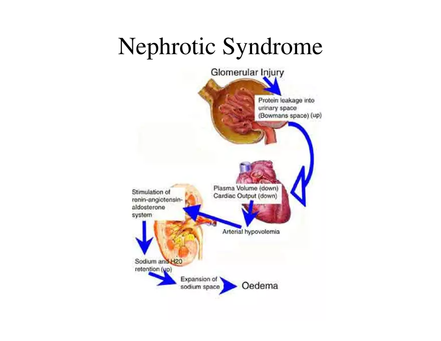 Urinary System Lecture - Page 44