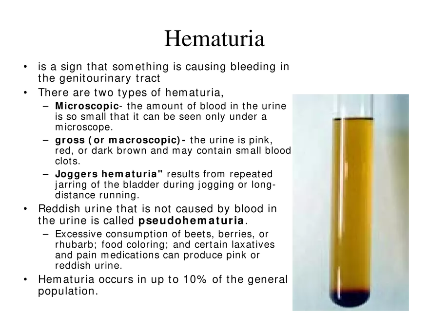 Urinary System Lecture - Page 45