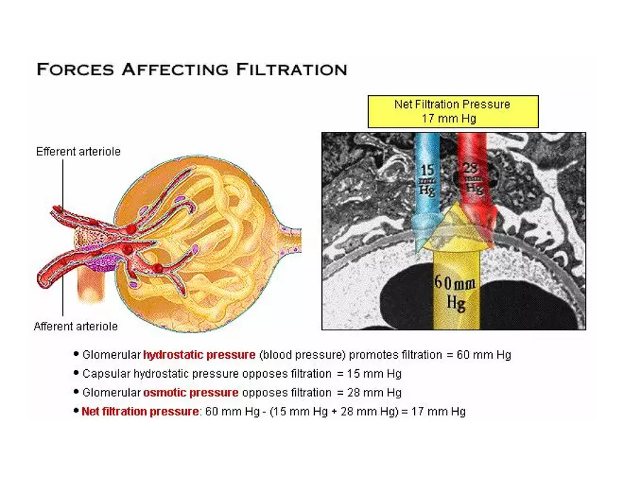 Urinary System Lecture - Page 49