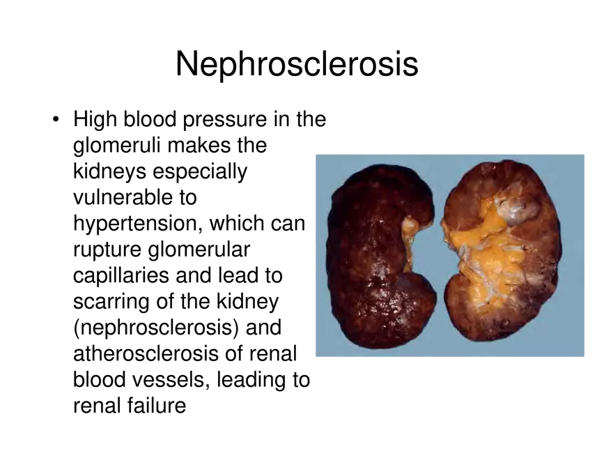 Urinary System Lecture - Page 50