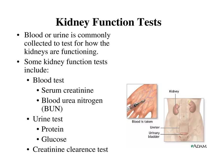 Urinary System Lecture - Page 54