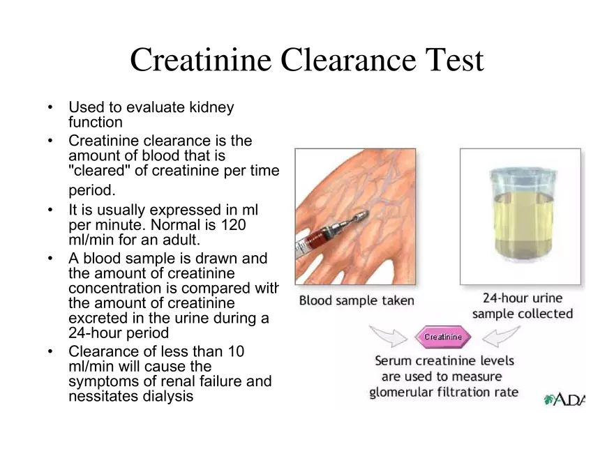 Urinary System Lecture - Page 56