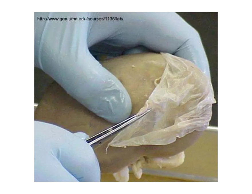 Urinary System Lecture - Page 57