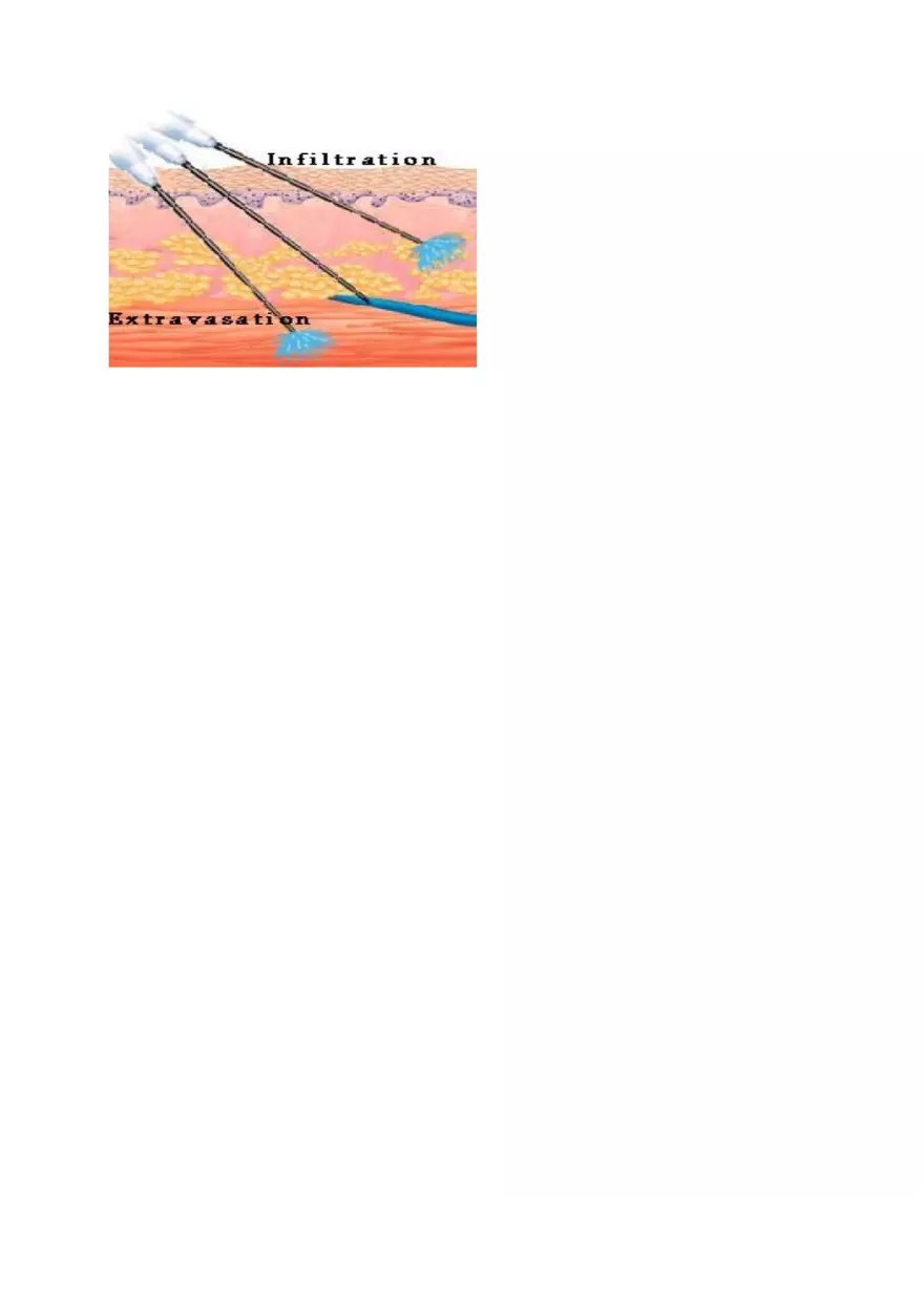 IV Insertion - Page 6