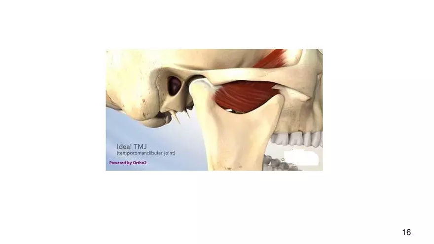 Chapter 9 Articulations - Page 10