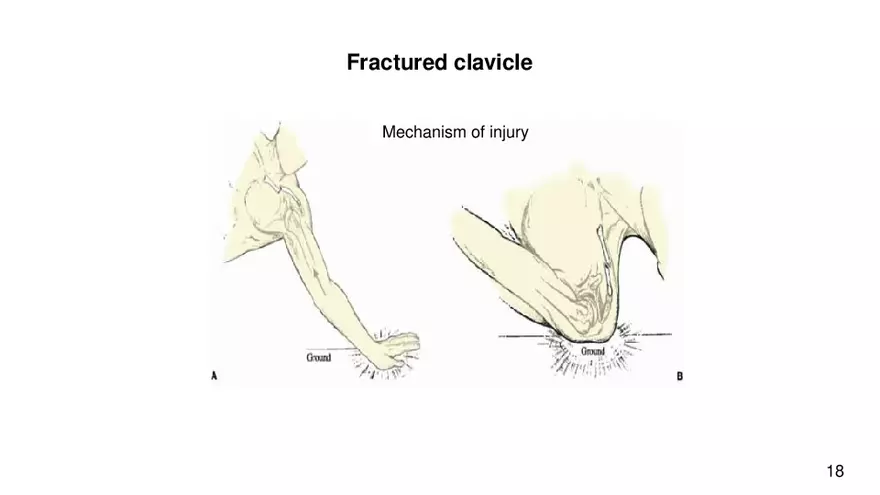 Chapter 9 Articulations - Page 12