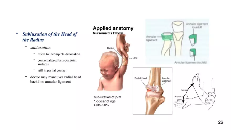 Chapter 9 Articulations - Page 21