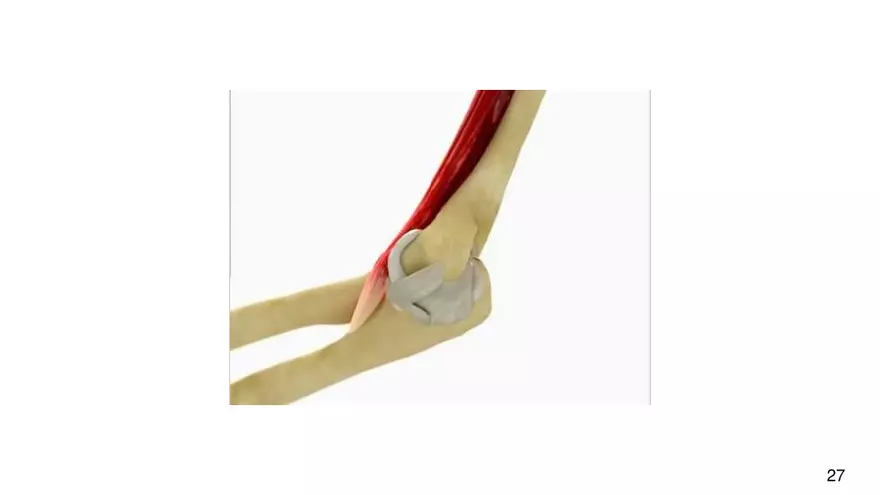 Chapter 9 Articulations - Page 22