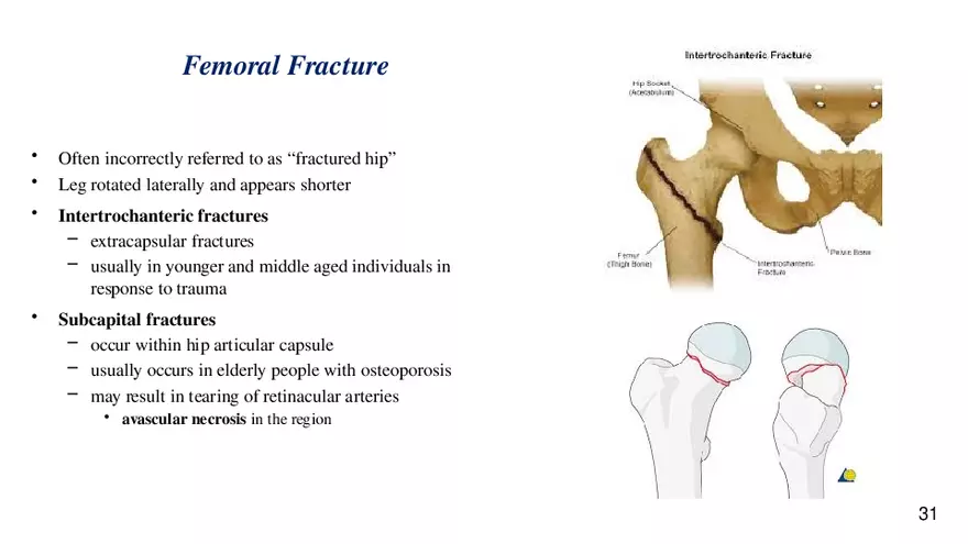Chapter 9 Articulations - Page 27