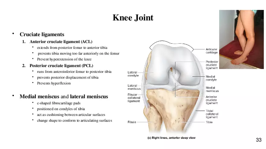 Chapter 9 Articulations - Page 29