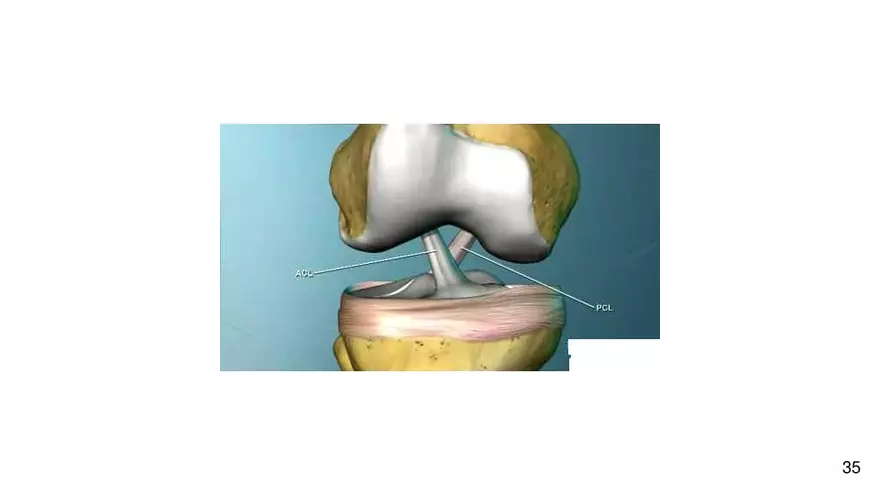 Chapter 9 Articulations - Page 31