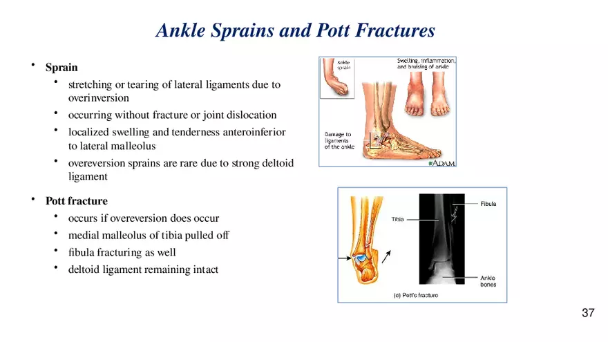 Chapter 9 Articulations - Page 33
