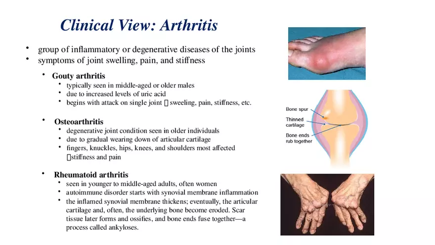 Chapter 9 Articulations - Page 40