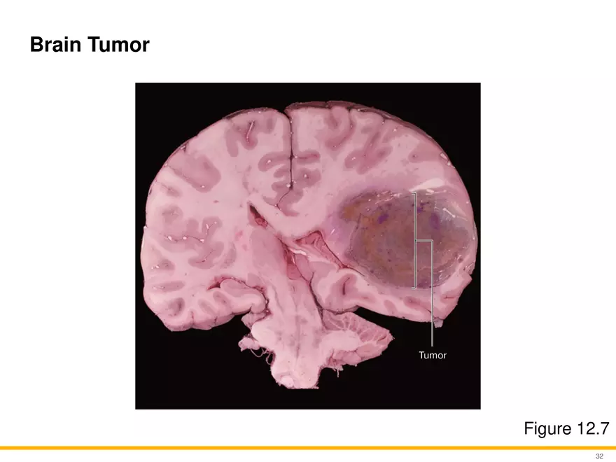 12.3 Supportive Cells - Page 21