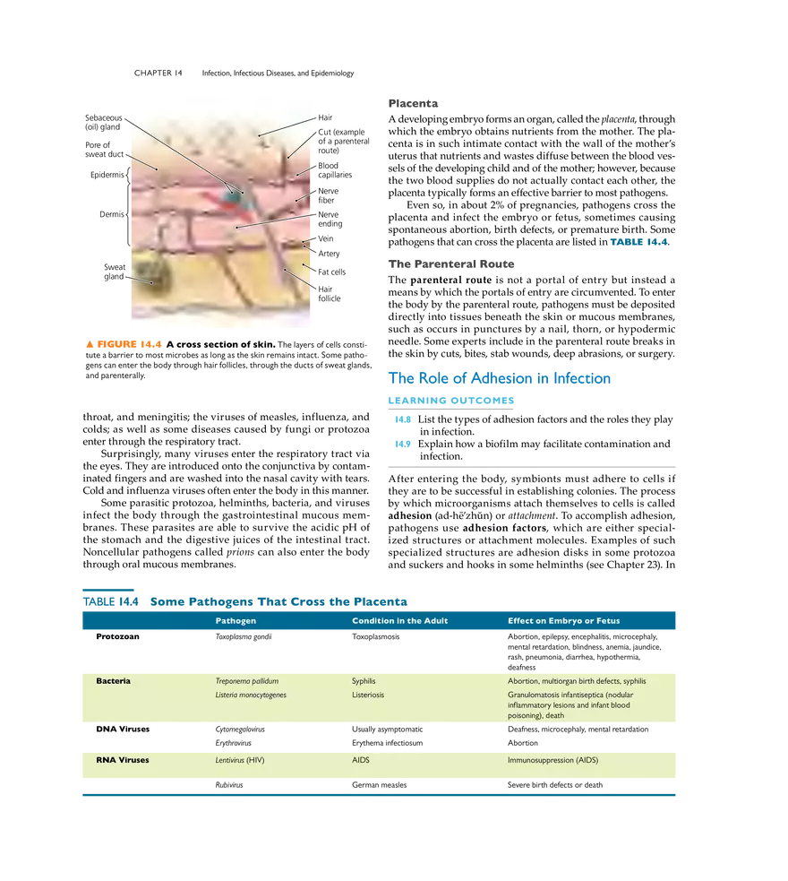 Infection, Infectious Disease, and Epidemiology - Page 30
