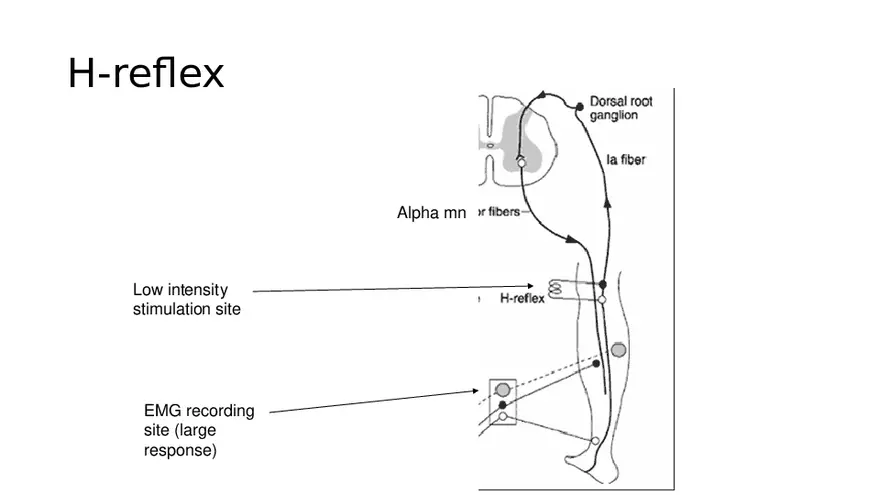 Spinal Cord - Page 43