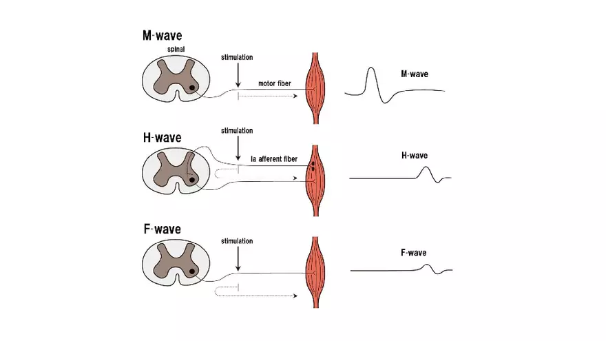 Spinal Cord - Page 45