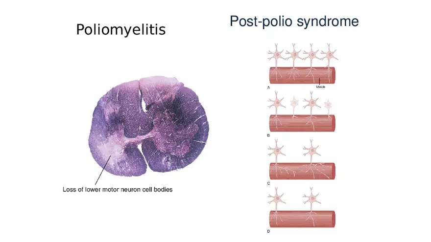 Spinal Cord - Page 55