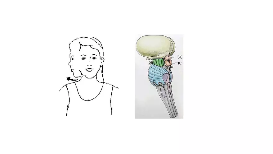 Spinal Cord - Page 88