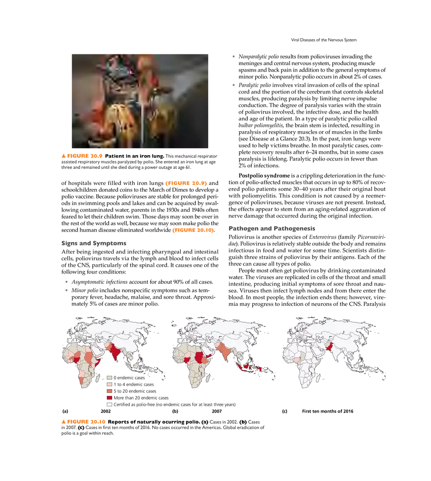 Microbial Diseases of the Nervous System and Eyes - Page 8