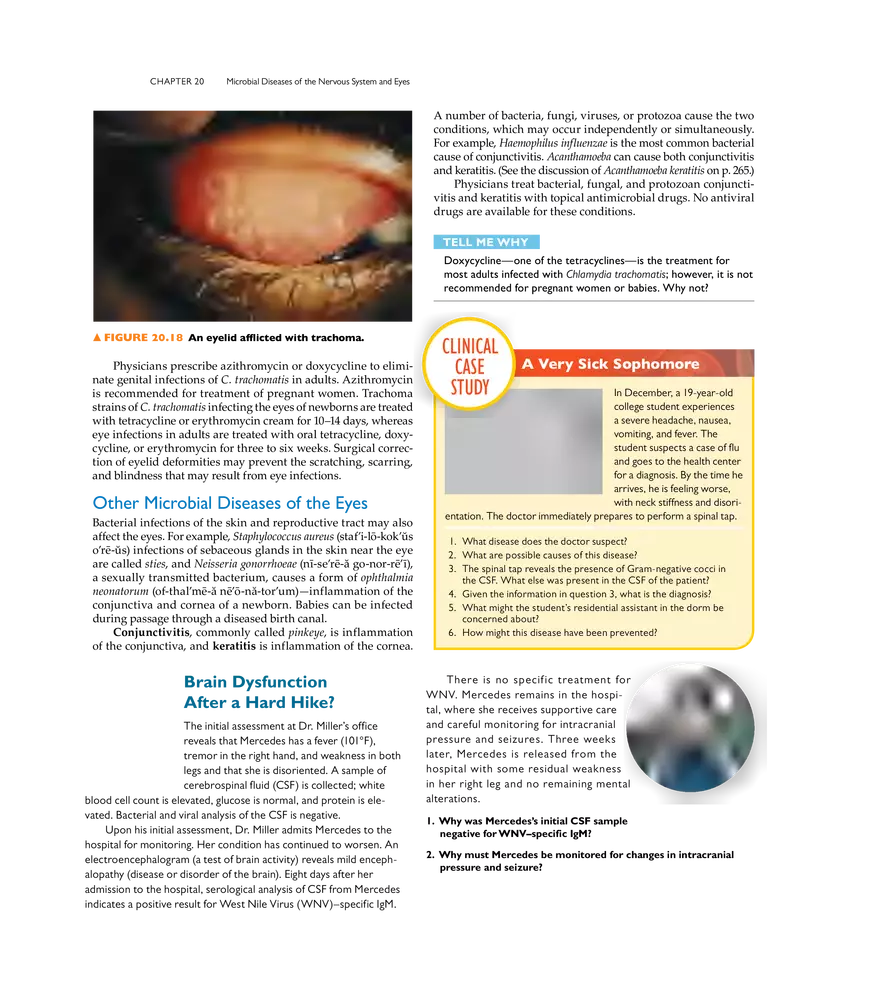 Microbial Diseases of the Nervous System and Eyes - Page 22