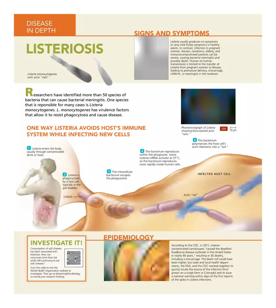 Microbial Diseases of the Nervous System and Eyes - Page 30