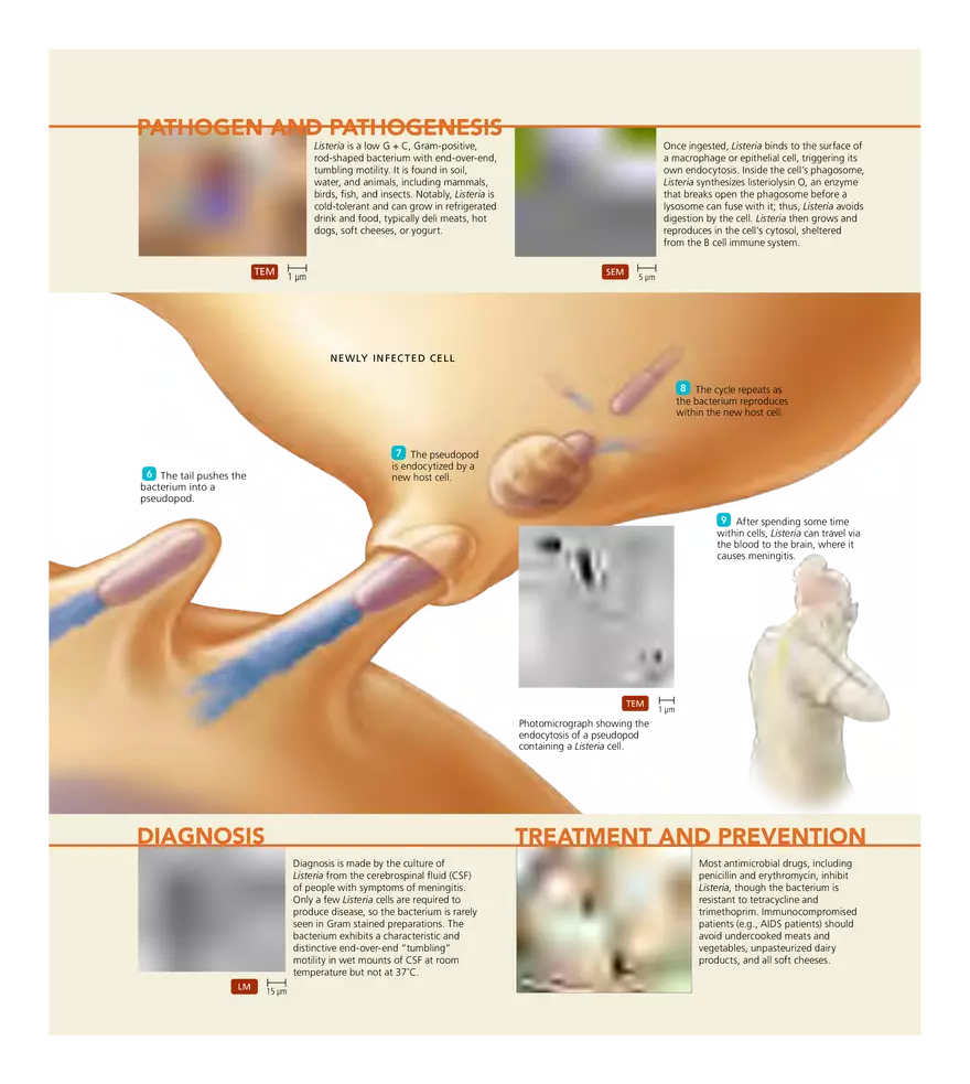 Microbial Diseases of the Nervous System and Eyes - Page 31