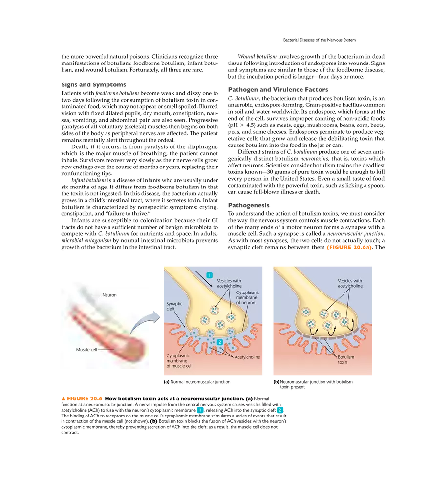 Microbial Diseases of the Nervous System and Eyes - Page 33