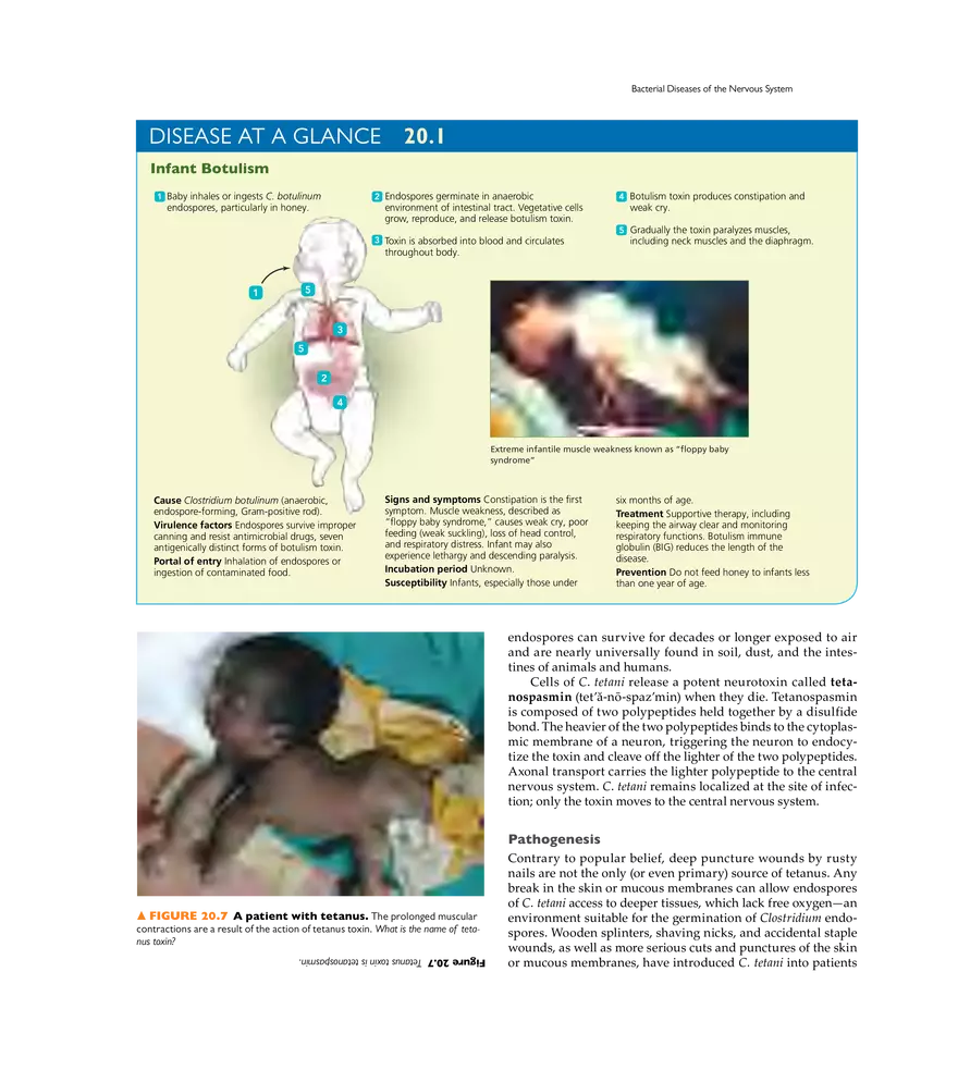 Microbial Diseases of the Nervous System and Eyes - Page 4