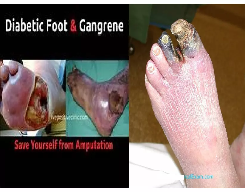 Healthy Living with Diabetes - Page 10