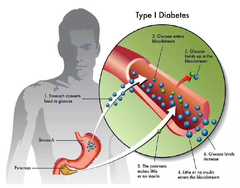 Healthy Living with Diabetes - Page 17