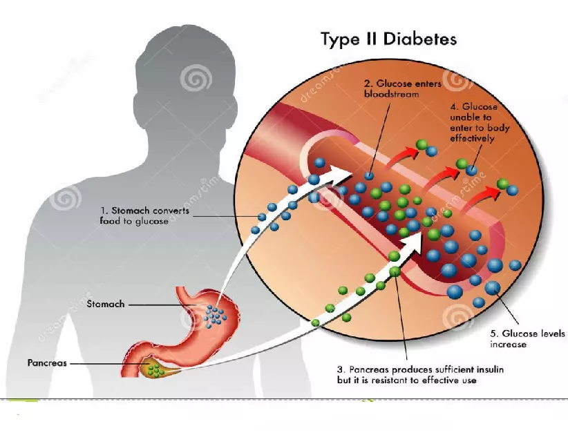 Healthy Living with Diabetes - Page 19