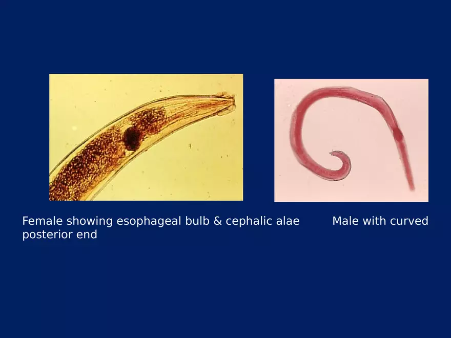 Enterobius Vermicularis - Page 16