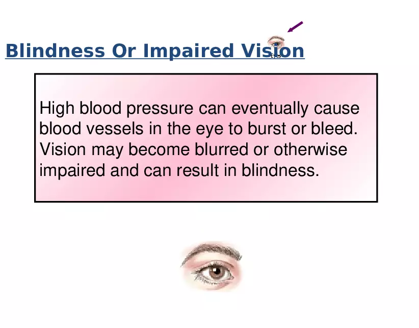 High Blood Pressure - Page 12