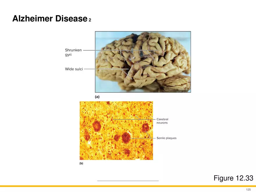12.6 Neural Integration - Page 21