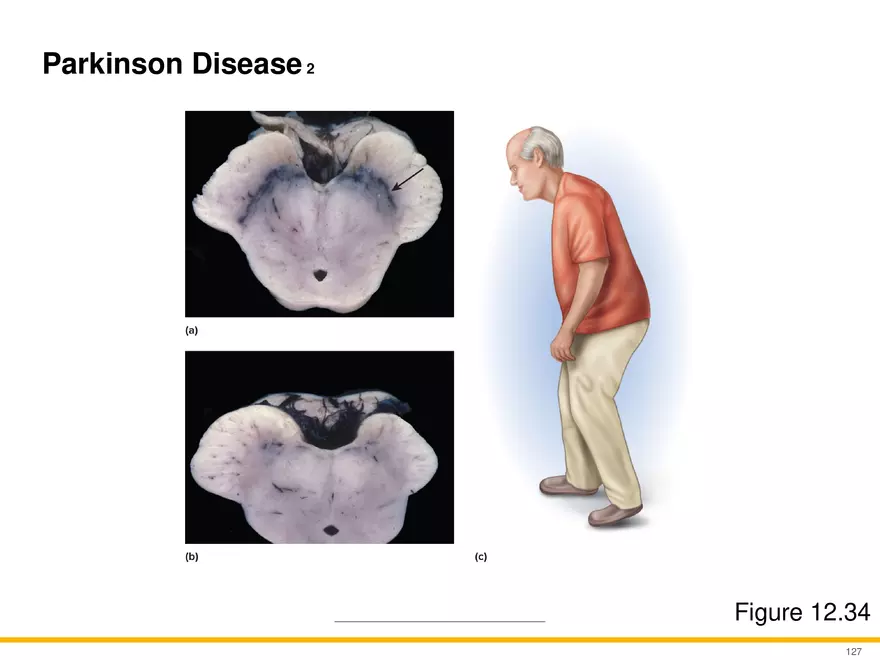 12.6 Neural Integration - Page 23