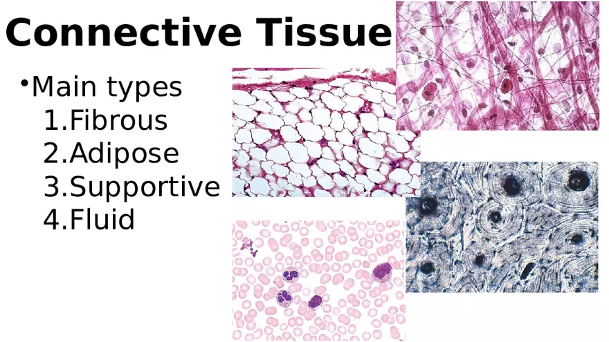 Chapter 5 Tissues – Epithelial, Connective, Muscle, Nervous, Membranes (Continued) - Page 13