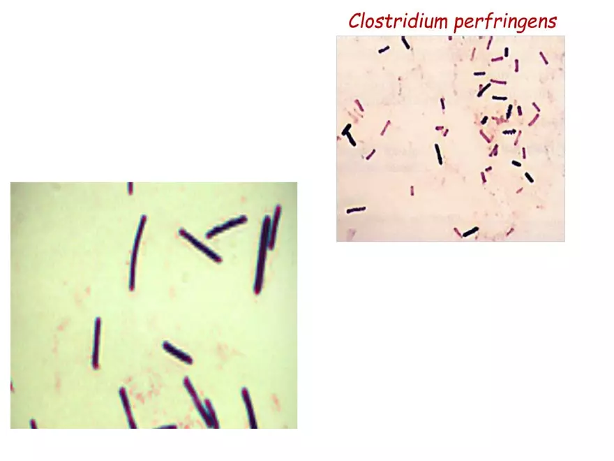 Clostridium Perfringens BTY618 - Page 13
