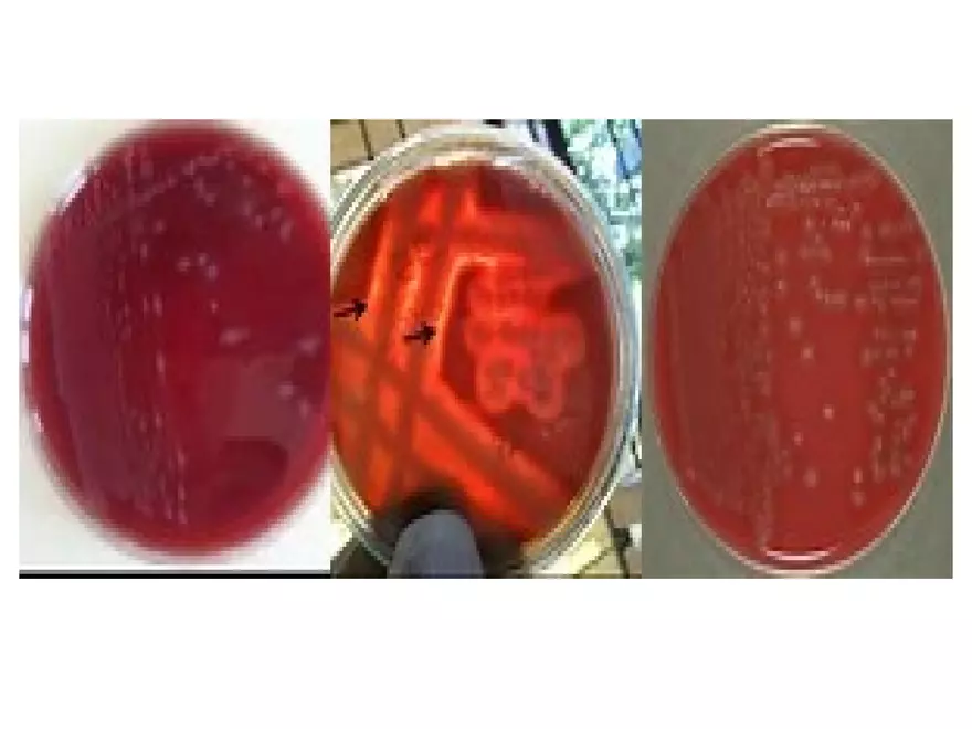 Clostridium Perfringens BTY618 - Page 26