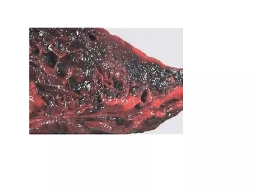 Clostridium Perfringens BTY618 - Page 30