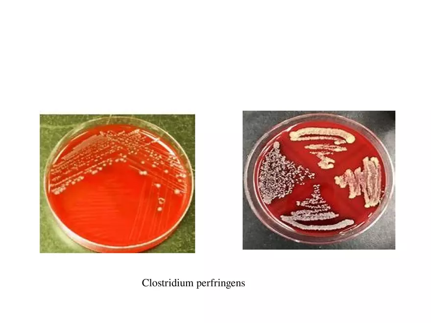 Clostridium Perfringens BTY618 - Page 34
