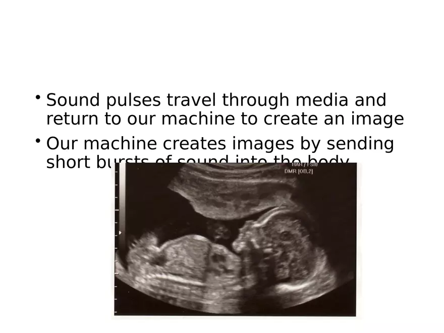 Ultrasound Physics Chapter 2 Sound - Page 24