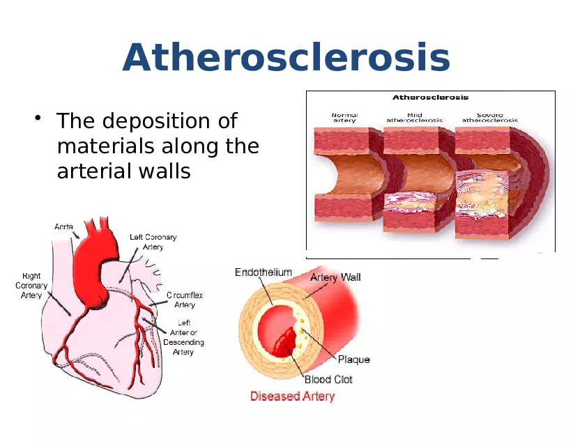 Heart Diseases - Page 8