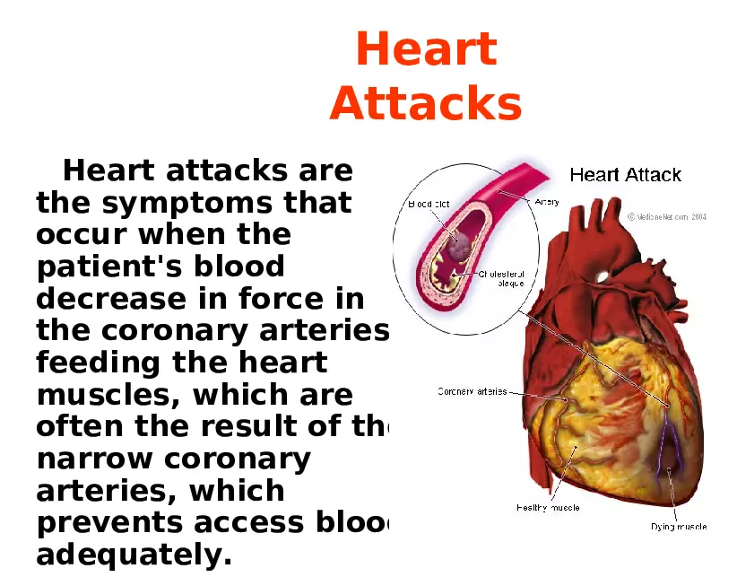 Heart Diseases - Page 14