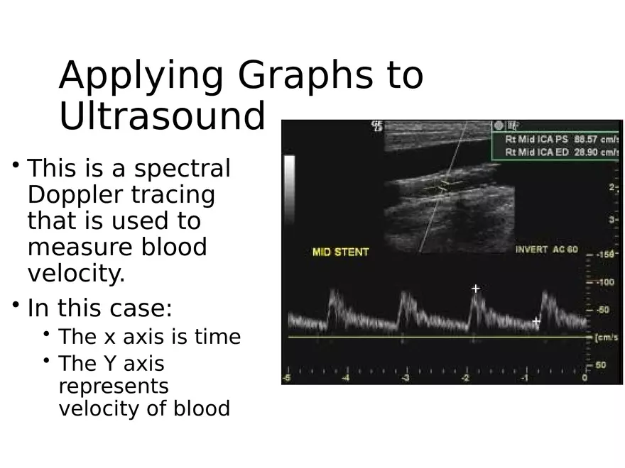 Ultrasound Physics Chapter 1 The Basics - Page 19