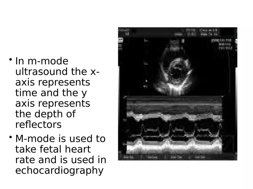 Ultrasound Physics Chapter 1 The Basics - Page 20