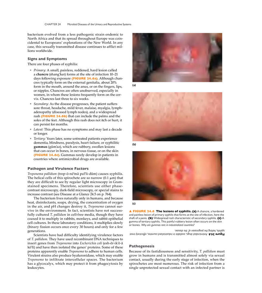 Microbial Diseases of the Urinary and Reproductive Systems - Page 7